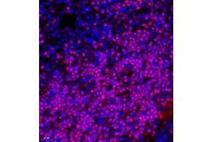 Immunofluorescence of paraffin embedded rat thymus using TCF7 (ABIN7075952) at dilution of 1:600 (400x lens) (TCF7 Antikörper)