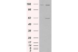 Western Blotting (WB) image for Monoamine Oxidase A (MAOA) peptide (ABIN368822) (Monoamine Oxidase A (MAOA) Peptid)