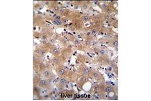 TR Antibody (Center) (ABIN655714 and ABIN2845164) immunohistochemistry analysis in formalin fixed and paraffin embedded human liver tissue followed by peroxidase conjugation of the secondary antibody and DAB staining. (TRPM8 Antikörper  (AA 263-292))