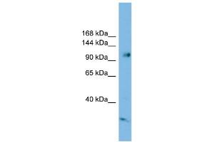 WB Suggested Anti-SMEK1 Antibody Titration: 0. (SMEK1 Antikörper  (Middle Region))