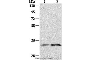 Western blot analysis of Human fetal kidney and intestine tissue, using IL1RL1 Polyclonal Antibody at dilution of 1:1100 (IL1RL1 Antikörper)