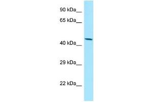 WB Suggested Anti-MMP28 Antibody Titration: 1.