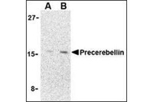 Western blot analysis of precerebellin in 293 cell lysate with precerebellin AP30690PU-N at (A) 2 and (B) 4 μg/ml. (CBLN1 Antikörper  (C-Term))