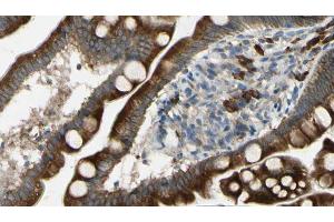 ABIN6267436 at 1/100 staining Mouse intestine tissue by IHC-P. (CBL Antikörper  (pTyr674))