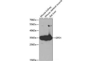 Western blot analysis of extracts of various cell lines using GPD1 Polyclonal Antibody at dilution of 1:1000. (GPD1 Antikörper)