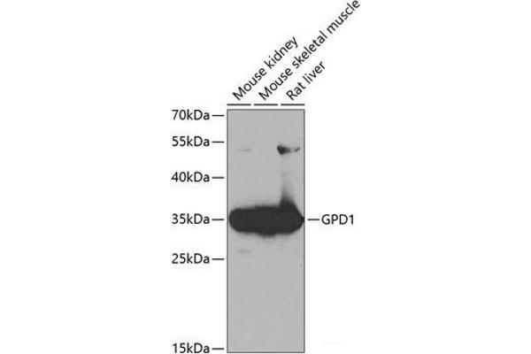 GPD1 anticorps