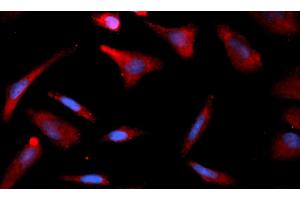 Immunofluorescence (IF) image for anti-CNDP Dipeptidase 2 (Metallopeptidase M20 Family) (CNDP2) (AA 1-475) antibody (APC) (ABIN5565179)