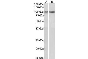 ABIN5539639 (1µg/ml) staining of Human (A) and Mouse (B) Heart lysates (35µg protein in RIPA buffer). (ITGA3 Antikörper  (C-Term))