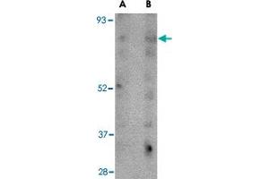 Western blot analysis of SCARB2 in human skeletal muscle tissue lysate with SCARB2 polyclonal antibody  at (A) 1 and (B) 2 ug/mL . (SCARB2 Antikörper  (C-Term))