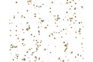 Immunocytochemistry (ICC) image for anti-B-cell antigen receptor complex-associated protein alpha chain (CD79A) (AA 33-143) antibody (ABIN7453962)