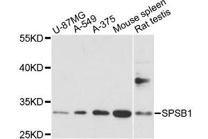Western blot analysis of extracts of various cell lines, using SPSB1 antibody. (SPSB1 Antikörper)
