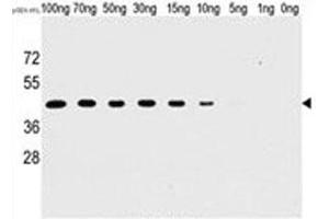 Western blot analysis of H1L antibody and recombinant H1L protein. (Tyr/ser Protein Phosphatase Antikörper)