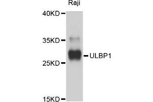 Western blot analysis of extracts of Raji cells, using ULBP1 antibody. (ULBP1 Antikörper)