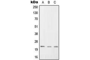 Western blot analysis of RGS1 expression in K562 (A), Raw264.