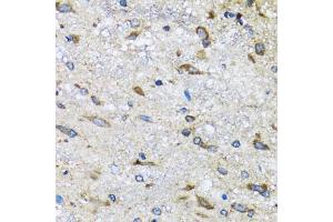 Immunohistochemistry of paraffin-embedded mouse spinal cord using BLZF1 antibody (ABIN5973830) at dilution of 1/100 (40x lens).