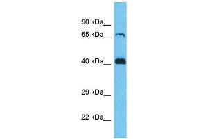 Western Blotting (WB) image for anti-Secretion Regulating Guanine Nucleotide Exchange Factor (SERGEF) (C-Term) antibody (ABIN2791907) (SERGEF Antikörper  (C-Term))