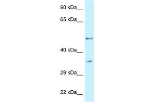 WB Suggested Anti-PFKFB1 Antibody Titration: 1. (PFKFB1 Antikörper  (C-Term))