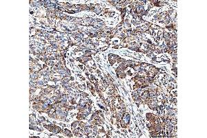 IHC analysis of MUT using anti-MUT antibody (ABIN4886676).