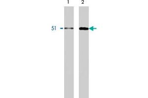 Western blot using HNRNPK monoclonal antibody, clone F45 P9 C7  on Calu-6 (1) and HT-29 (2) cell lysates. (HNRNPK Antikörper  (C-Term))