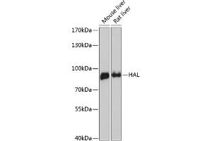 Western blot analysis of extracts of various cell lines, using HAL antibody (ABIN6130467, ABIN6141593, ABIN6141594 and ABIN6216851) at 1:3000 dilution. (HAL Antikörper  (AA 1-200))