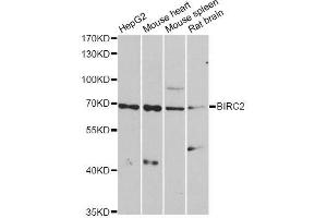 Western blot analysis of extracts of various cell lines, using BIRC2 antibody. (BIRC2 Antikörper  (AA 1-300))