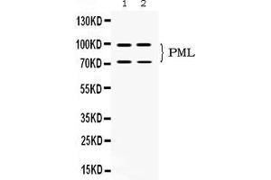 Western blot analysis of PML Protein expression in SW620 whole cell lysates ( Lane 1) and U2OS whole cell lysates ( Lane 2). (PML Antikörper  (N-Term))