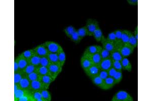 Immunofluorescence analysis of PC-12 cells using ARRB1 antibody (ABIN4903044). (beta Arrestin 1 Antikörper)