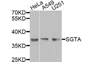 Western blot analysis of extracts of various cells, using SGTA antibody. (SGTA Antikörper)
