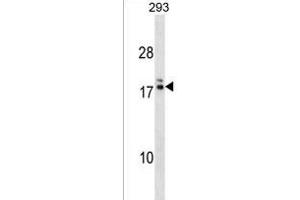 HIATL2 Antibody (N-term) (ABIN1538895 and ABIN2838153) western blot analysis in 293 cell line lysates (35 μg/lane).