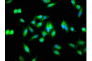 Immunofluorescence staining of Hela cells with ABIN7161777 at 1:133, counter-stained with DAPI. (NFKB2 Antikörper  (AA 263-439))