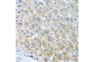 Immunohistochemistry of paraffin-embedded human liver using UBE2U antibody (ABIN5974574) at dilution of 1/100 (40x lens). (UBE2U Antikörper)