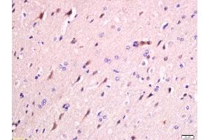 Formalin-fixed and paraffin embedded rat brain labeled with Anti-FAM134B Polyclonal Antibody, Unconjugated  at 1:200 followed by conjugation to the secondary antibody and DAB staining (FAM134B Antikörper  (AA 210-310))