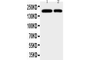 Anti-CD11b antibody, All Western blottingAll lanes: Anti-ITGAM at 0. (CD11b Antikörper  (N-Term))