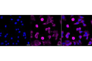 Immunocytochemical staining of HepG2 cells with GABBR1 antibody (ABIN7798690), 1:1,000). (Rekombinanter GABBR1 Antikörper)