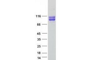 Validation with Western Blot