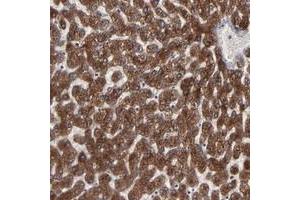 Immunohistochemical staining of human liver with CNIH polyclonal antibody  shows strong cytoplasmic positivity in hepatocytes at 1:50-1:200 dilution.