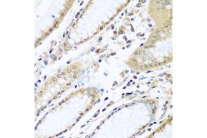 Immunohistochemistry of paraffin-embedded human stomach using WDR48 antibody (ABIN5974731) at dilution of 1/100 (40x lens). (WDR48 Antikörper)