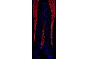human scalp hair (courtesy of L. (KRT16 Antikörper)