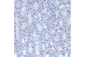 Immunohistochemistry of paraffin-embedded mouse kidney using A Rabbit mAb (ABIN7265387) at dilution of 1:100 (40x lens). (BAF53A Antikörper)