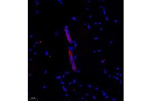 Immunofluorescence (Paraffin-embedded Sections) (IF (p)) image for anti-Cbp/p300-Interacting Transactivator, with Glu/Asp-Rich Carboxy-terminal Domain, 4 (CITED4) antibody (ABIN7073356)