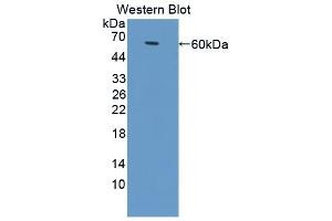 Detection of Recombinant ALCAM, Bovine using Polyclonal Antibody to Activated Leukocyte Cell Adhesion Molecule (ALCAM) (CD166 Antikörper  (AA 28-527))