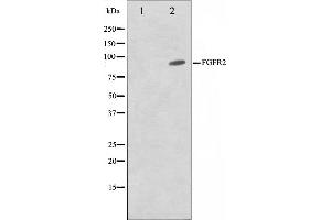 Western blot analysis on A549 cell lysate using FGFR2 Antibody,The lane on the left is treated with the antigen-specific peptide. (FGFR2 Antikörper  (C-Term))