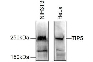 Western Blot of anti-TIP5 antibody Western Blot results of Rabbit anti-TIP5 antibody. (BAZ2A Antikörper)