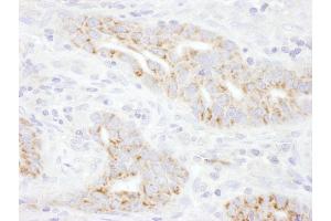 Immunohistochemistry (IHC) image for anti-Thioredoxin Interacting Protein (TXNIP) (AA 300-350) antibody (ABIN7454484)