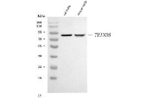 Western blot analysis of TRIM36 using anti-TRIM36 antibody (ABIN7600059).
