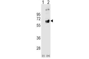 Western blot analysis of FYN antibody and 293 cell lysate (2 ug/lane) either nontransfected (Lane 1) or transiently transfected (2) with the FYN gene. (FYN Antikörper  (AA 13-43))