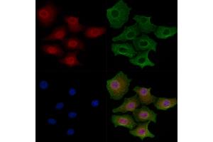 ABIN6260857 and ABIN6266905 staining Hela cells by IF/ICC.