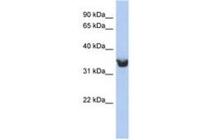 Image no. 1 for anti-delta-Like 1 Homolog (Drosophila) (DLK1) (AA 251-300) antibody (ABIN6743247) (DLK1 Antikörper  (AA 251-300))