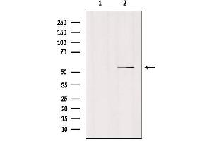 Western blot analysis of extracts from mouse brain, using MOT6 Antibody. (SLC16A5 Antikörper  (Internal Region))