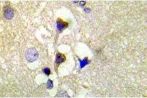 Immunohistochemistry (IHC) analyzes of p-PKD1/PKC-mu antibody in paraffin-embedded human brain tissue. (PKC mu Antikörper  (pSer910))